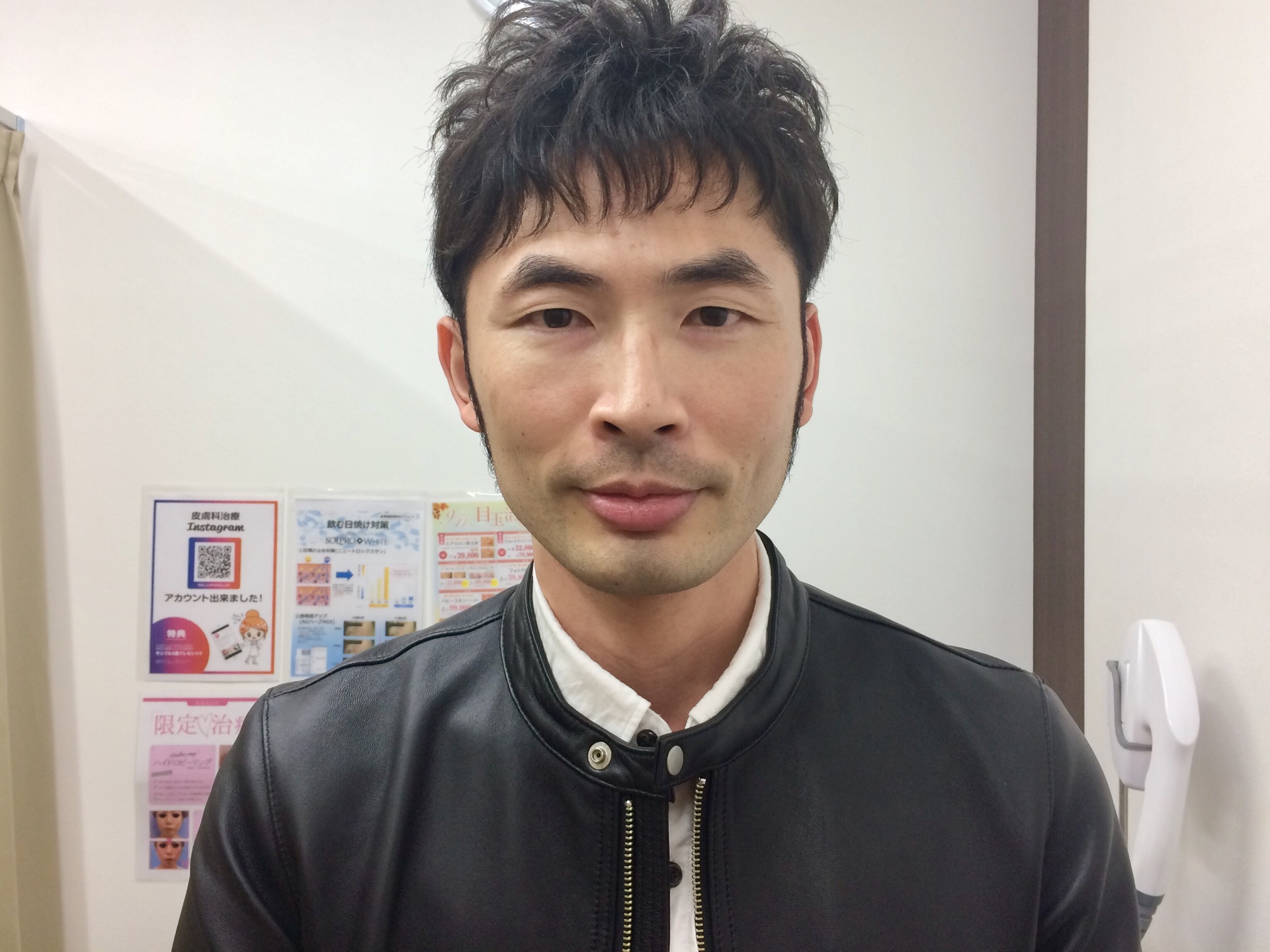 ひげ脱毛2回目の施術前