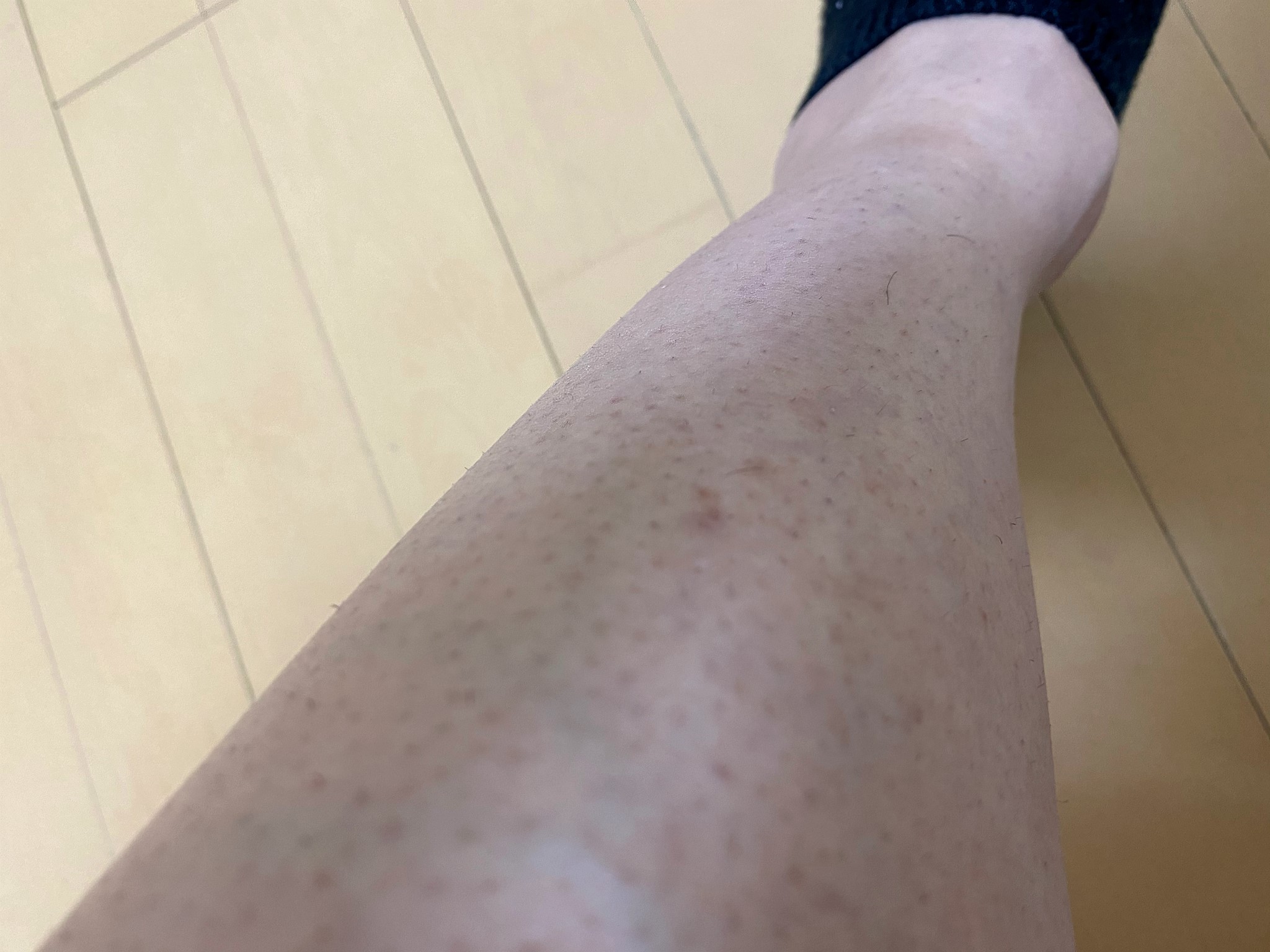 男のムダ毛処理にお勧めのシェーバー