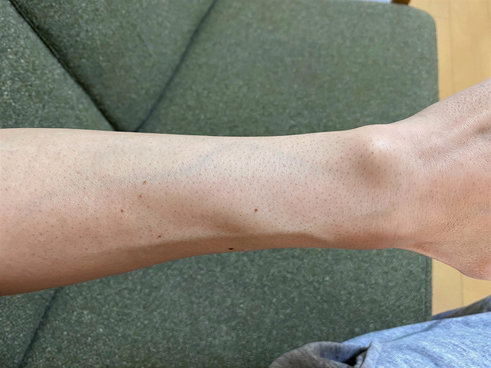 スティックシェーバーで腕毛を剃った後