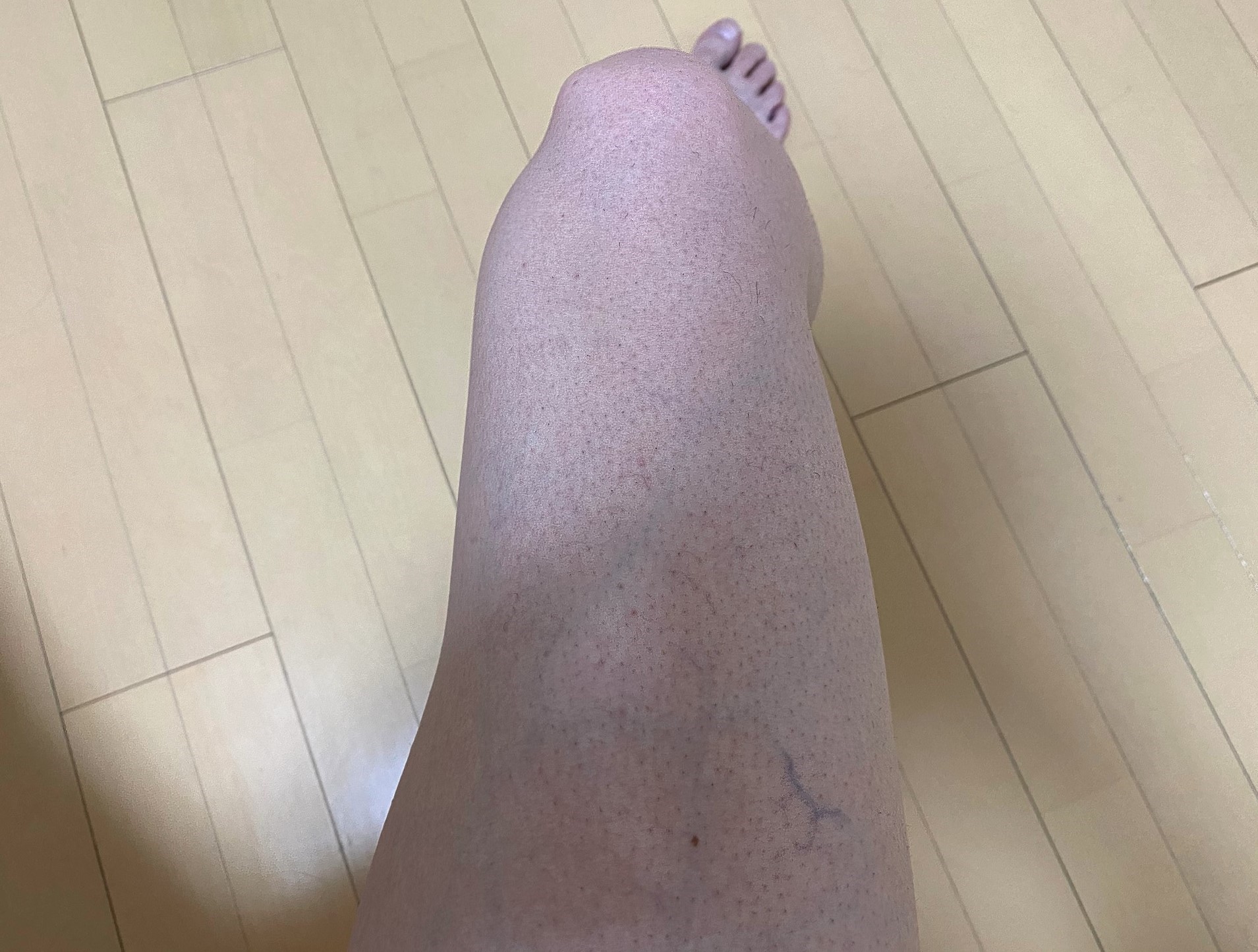 男の脚脱毛1回目の効果