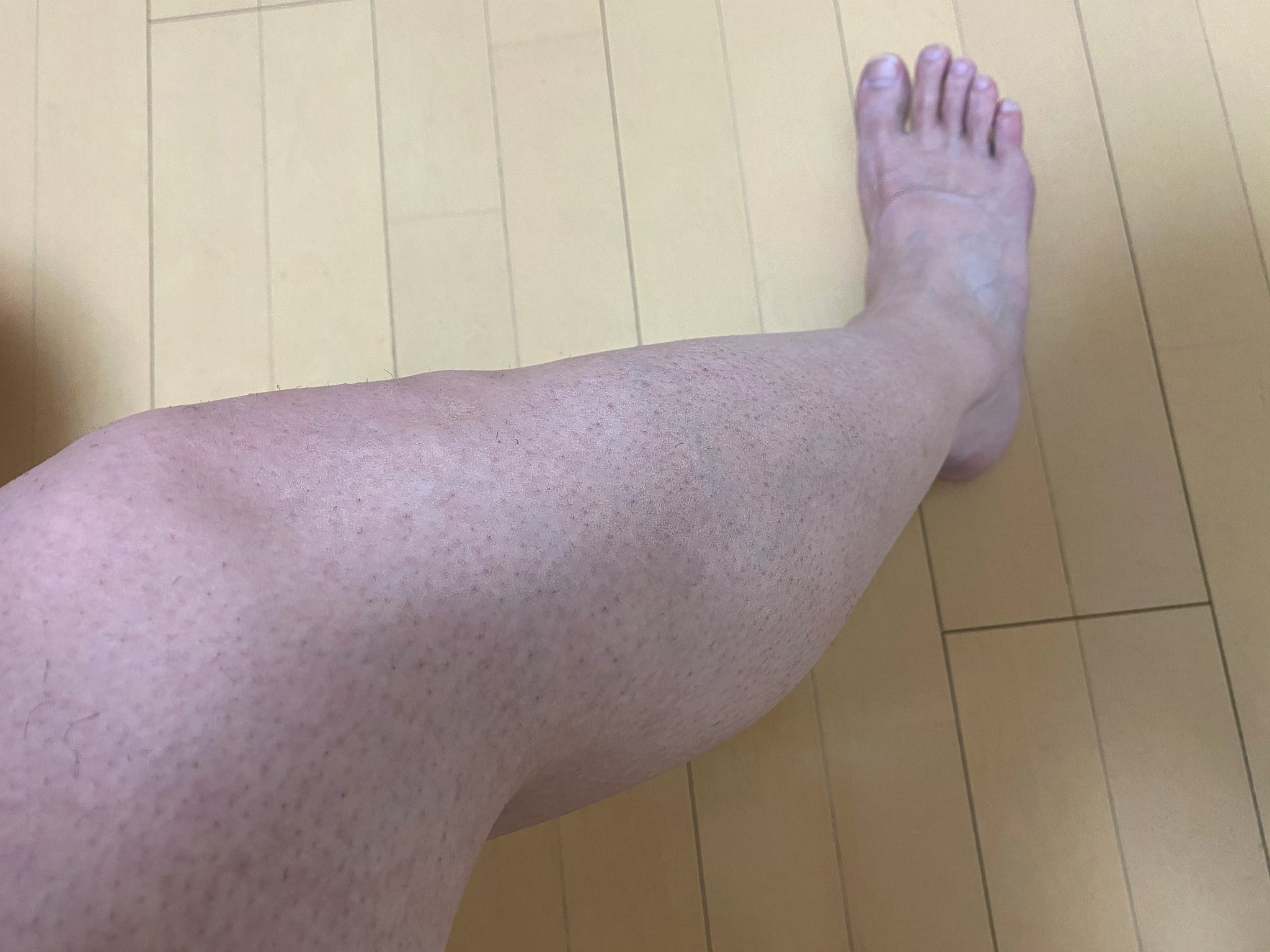 男の脚脱毛1回目の効果