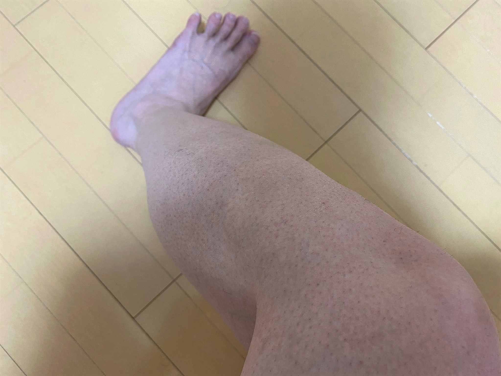 男の脚脱毛1回目の効果