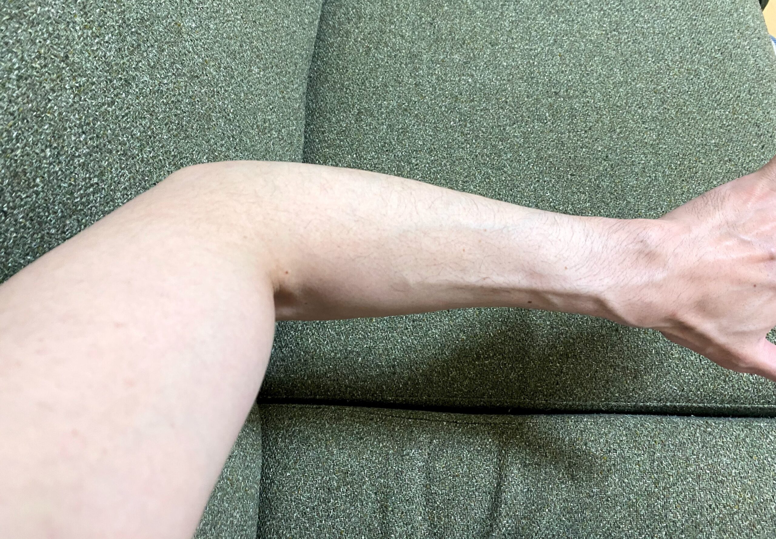 男の全身脱毛1回目の効果